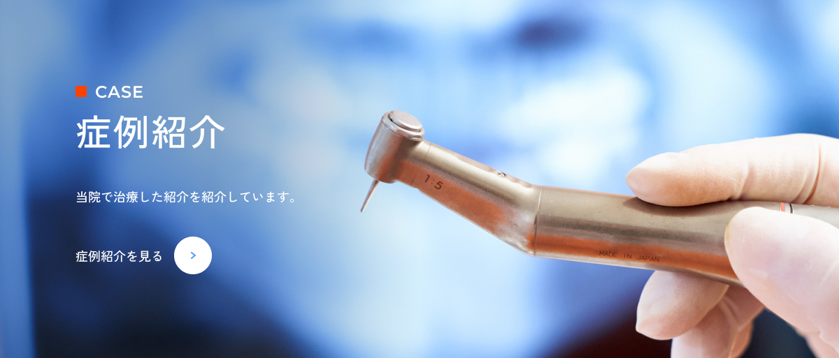 症例紹介を見る